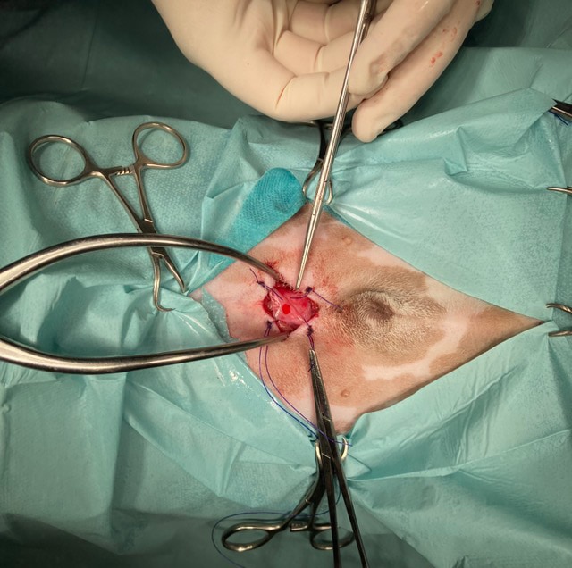 minimalna invazivna endoskopska kirurgija